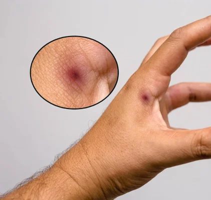 218. Teoria spiskowa staje się faktem