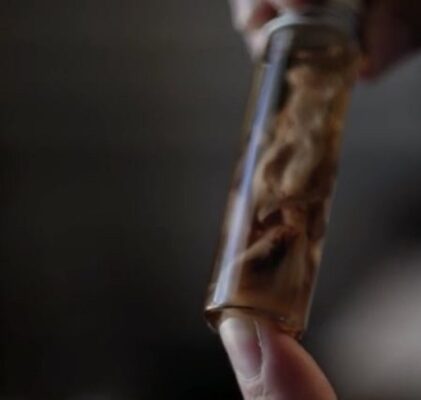 346. Dokumentacja nagłej śmierci