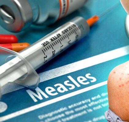 765. Die Masernimpfung verursacht Masern